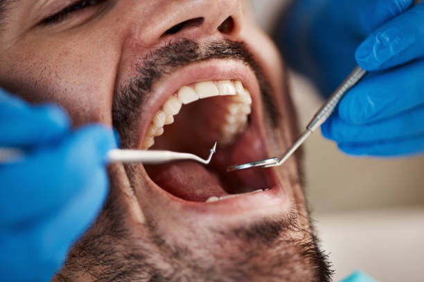 Best Full Mouth Reconstruction  in , ME